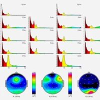 Sincronia_bono_mapeo_cerebral